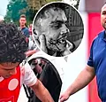 Schok in Nederland: assistent slaat tanden uit speler