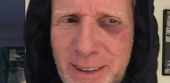 Materiaalman Club flink gehavend na knokpartij tegen Standard