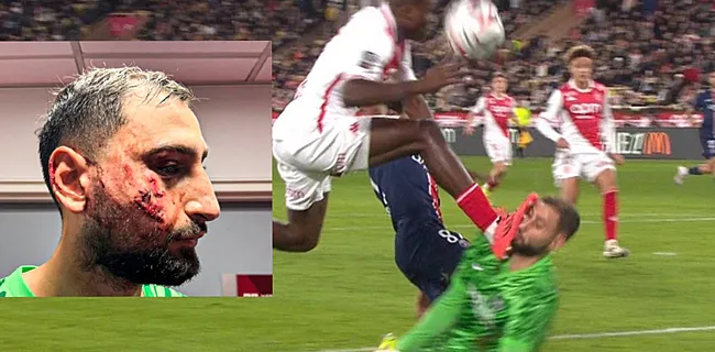 Engelse toppers door in EFL Cup, horrorblessure Donnarumma
