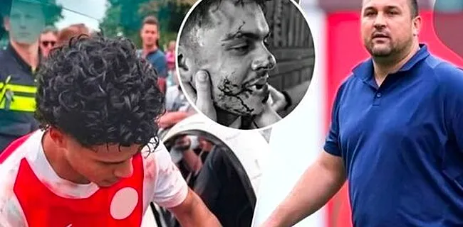 Schok in Nederland: assistent slaat tanden uit speler