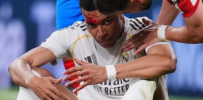 Mbappé vol bloed na slag: Arbeloa in alle staten