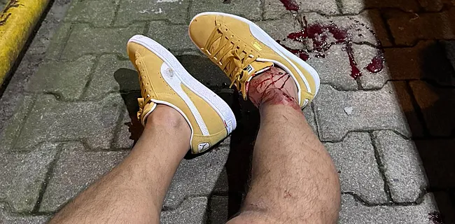 Shockerend: ex-RSCA'er in de voet geschoten na match Union