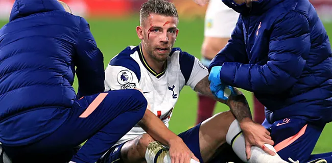 Mourinho komt met relatief goed nieuws over Alderweireld